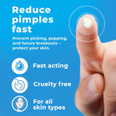 Pimple Patches for Face (120 Patches), Hydrocolloid Pimple Patches - Pimple Patch Zit Patch and Pimple Stickers - Hydrocolloid Pimple Dots for Pimples - Zit Patches