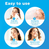 Pimple Patches for Face (120 Patches), Hydrocolloid Pimple Patches - Pimple Patch Zit Patch and Pimple Stickers - Hydrocolloid Pimple Dots for Pimples - Zit Patches